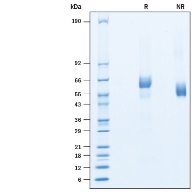 Recombinant Human GPR158 His-tag Protein SDS-PAGE