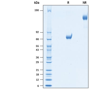 Recombinant Human GPVI Fc Chimera Protein SDS-PAGE