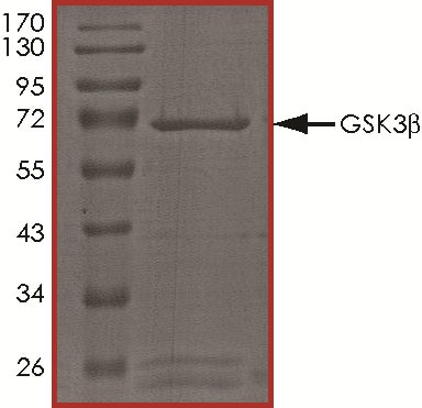 Recombinant Human Active GSK-3 beta Protein SDS-PAGE