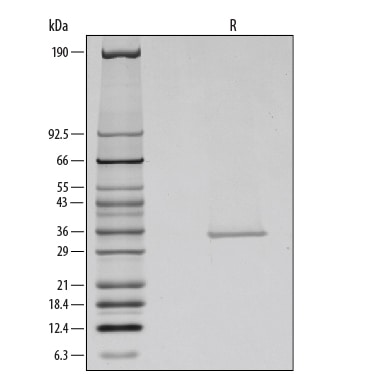 Recombinant Human Galectin-9 Protein SDS-PAGE