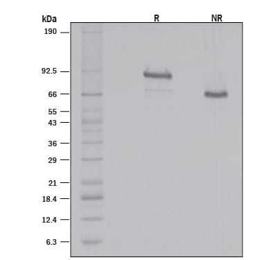 Recombinant Mouse Gas6 (Full Length) Protein SDS-PAGE