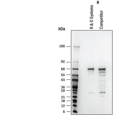 Recombinant Human Glutaminase His-tag Protein SDS-PAGE