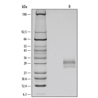 Recombinant Human Gremlin Protein SDS-PAGE