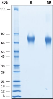 Recombinant Human Guanylyl Cyclase C His-tag Protein SDS-PAGE
