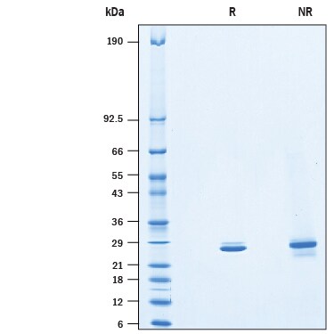 Recombinant Human HPRT His-tag Protein SDS-PAGE