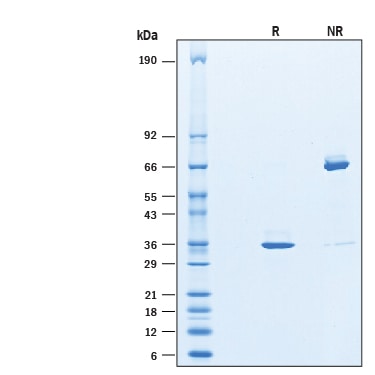 Recombinant Human Hepassocin/FGL1 His-tag Protein SDS-PAGE