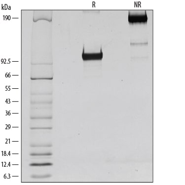 Recombinant Human ICAM-1/CD54 Fc Chimera Protein SDS-PAGE