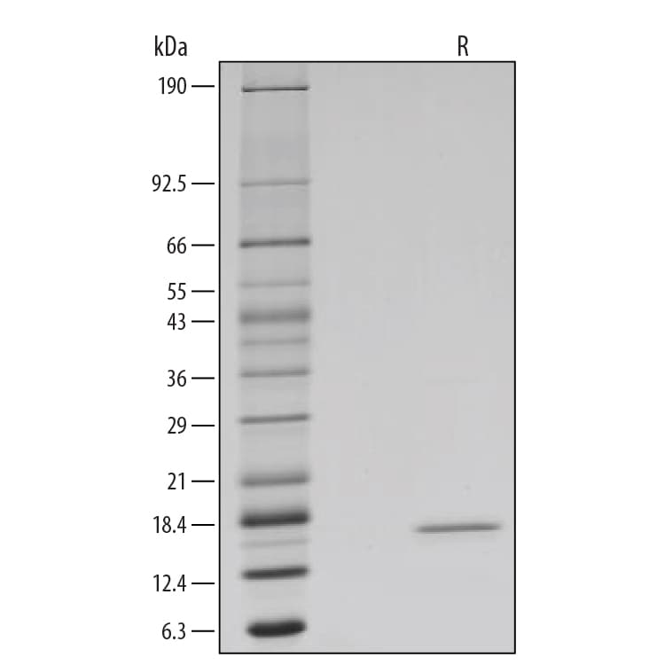 Recombinant Human IFN-gamma GMP Protein SDS-PAGE