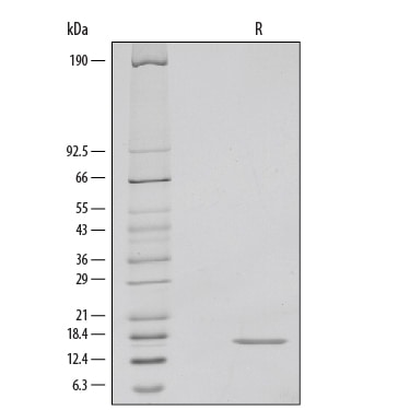 Recombinant Human IFN-gamma Protein SDS-PAGE