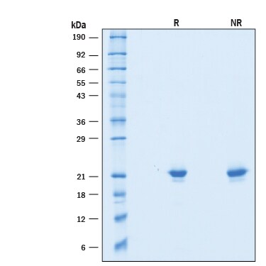Recombinant Mouse IFNAB Protein SDS-PAGE