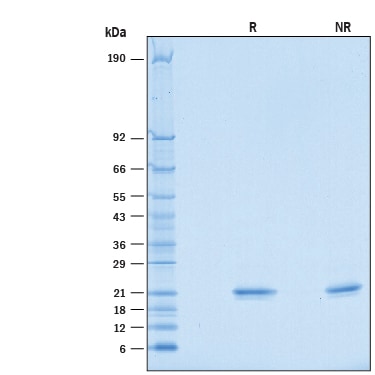 Recombinant Mouse IFN-alpha 2/IFNA2 Protein SDS-PAGE