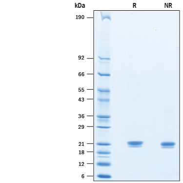 Recombinant Mouse IFN-alpha 9 Protein SDS-PAGE