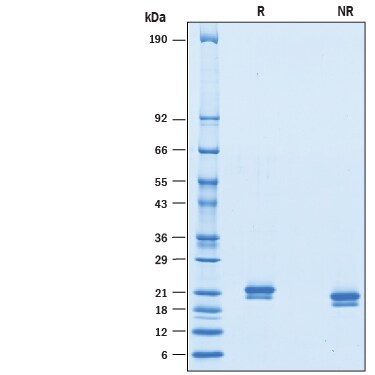 Recombinant Mouse IFN-alpha 7/IFNA7 Protein SDS-PAGE