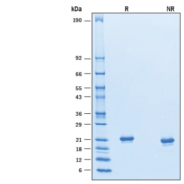 Recombinant Mouse IFN-alpha 6/IFNA6 Protein SDS-PAGE