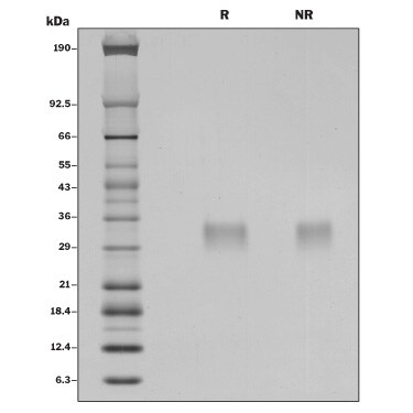 Recombinant Mouse IFN-beta Protein SDS-PAGE