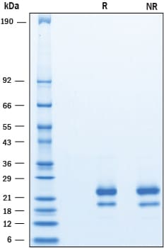 Recombinant Human IFN-gamma (HEK293-expressed) Protein SDS-PAGE