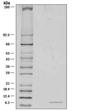 Recombinant Human IGF-II/IGF2 Protein SDS-PAGE