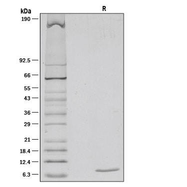 Recombinant Mouse IGF-I/IGF-1 Protein SDS-PAGE