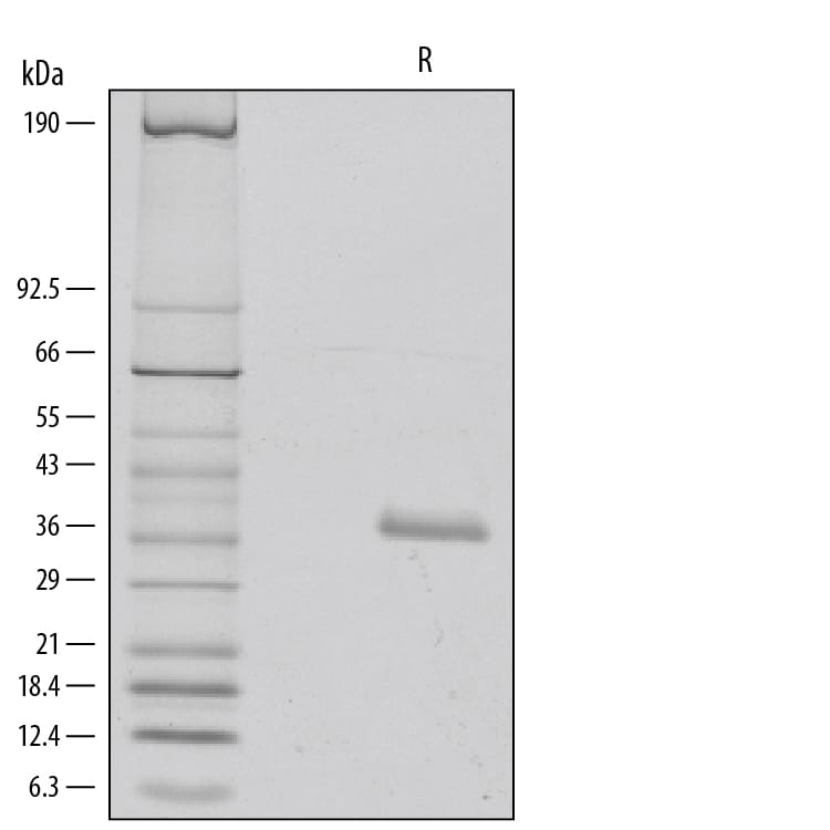 Recombinant Human IGFBP-rp1/IGFBP-7 (K95R) Protein SDS-PAGE