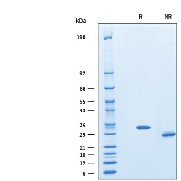 Recombinant Human IGFBP-rp1/IGFBP-7 Protein SDS-PAGE