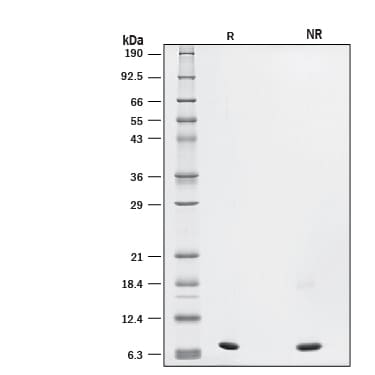 Recombinant Human LR3 IGF-I/IGF-1 GMP Protein SDS-PAGE