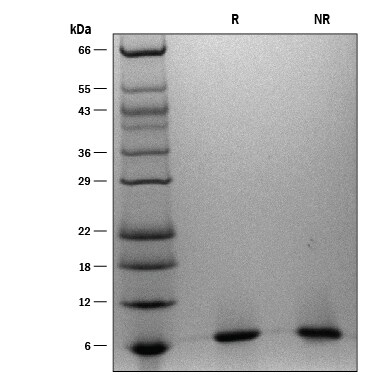 ProDots Recombinant Human IGF-I/IGF-1 Protein SDS-PAGE