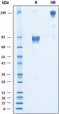 Recombinant Human IGSF4C/SynCAM4 Fc Chimera Protein SDS-PAGE