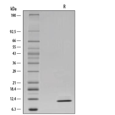 Recombinant Human IL-15 GMP Protein SDS-PAGE