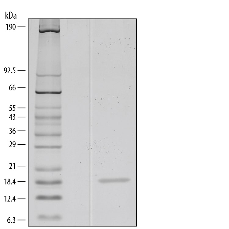 Recombinant Human IL-1 alpha/IL-1F1 Protein SDS-PAGE