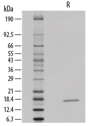 Recombinant Human IL-1 beta/IL-1F2 GMP Protein SDS-PAGE