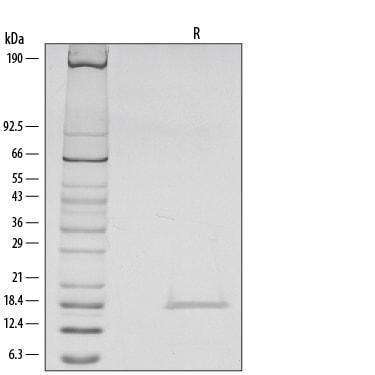 Recombinant Human IL-1 beta/IL-1F2 Protein SDS-PAGE