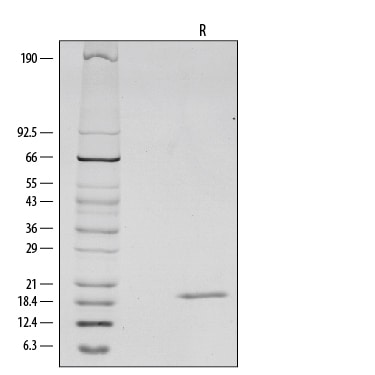 Recombinant Mouse IL-1 beta/IL-1F2 Protein SDS-PAGE