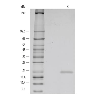 Recombinant Human IL-1ra/IL-1F3 Protein SDS-PAGE