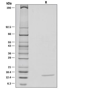 Recombinant Human IL-22 Protein SDS-PAGE