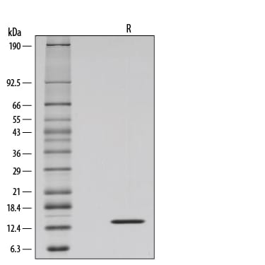 Recombinant Human IL-2 GMP Protein SDS-PAGE