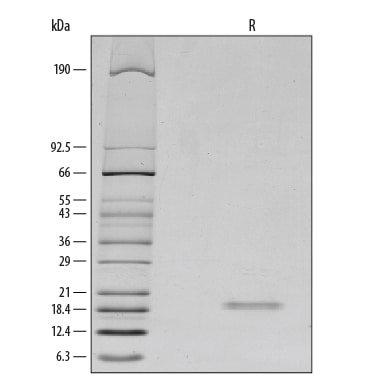 Recombinant Mouse IL-2 Protein SDS-PAGE