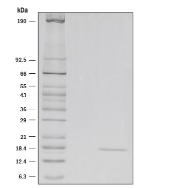 Recombinant Mouse IL-36 alpha/IL-1F6 (aa 8-160) Protein SDS-PAGE