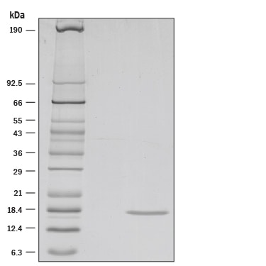 Recombinant Human IL-36 gamma/IL-1F9 (aa 18-169) Protein SDS-PAGE