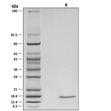 Recombinant Mouse IL-36 gamma/IL-1F9 (aa 13-164) Protein SDS-PAGE