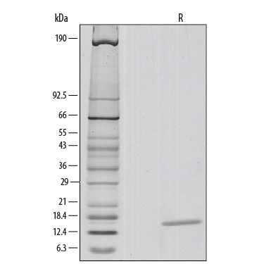 Recombinant Human IL-3 Protein SDS-PAGE