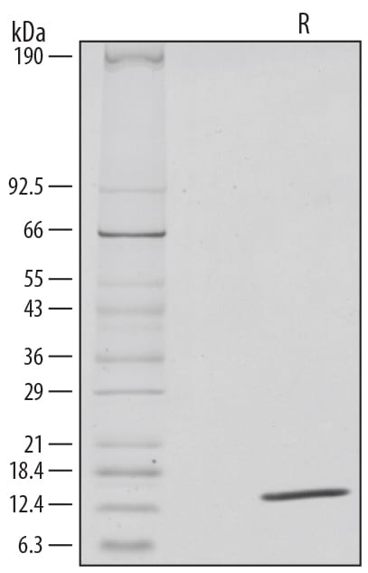 Recombinant Human IL-4 GMP Protein SDS-PAGE