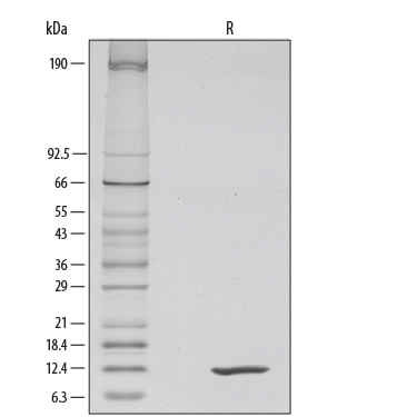 Recombinant Mouse IL-4 Protein SDS-PAGE