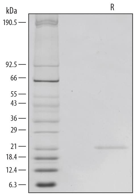 Recombinant Human IL-6 GMP Protein SDS-PAGE