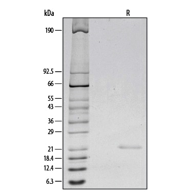 Recombinant Human IL-6 Protein SDS-PAGE