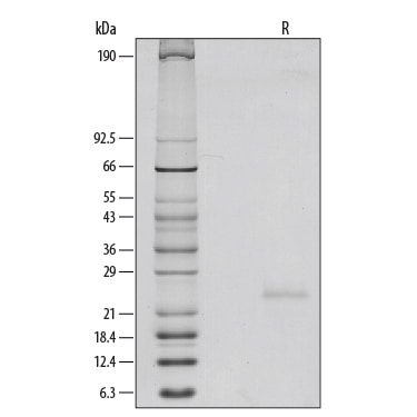 Recombinant Mouse IL-6 Protein SDS-PAGE