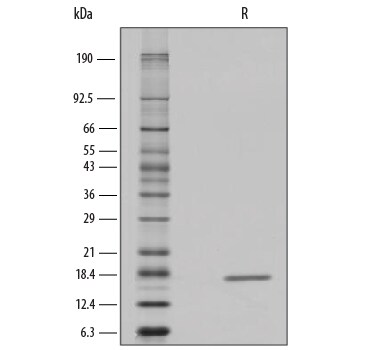 Recombinant Human IL-7 GMP Protein SDS-PAGE