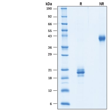 Recombinant Cynomolgus/Rhesus Macaque IL-17F His Protein SDS-PAGE