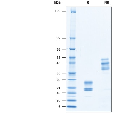 Recombinant Mouse IL-17F (Mammalian-expressed) Protein SDS-PAGE