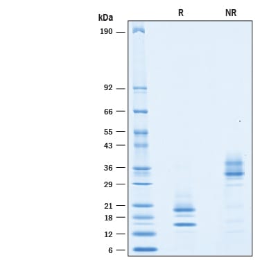 Recombinant Cynomolgus Monkey IL-17/IL-17A Protein SDS-PAGE