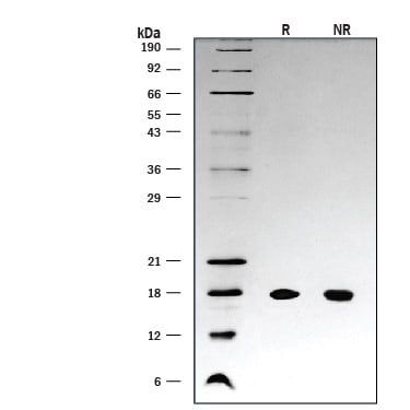 Recombinant Human IL-18/IL-1F4 Protein SDS-PAGE